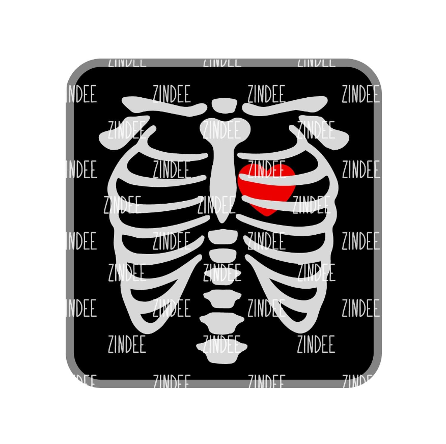 X-Ray image 0